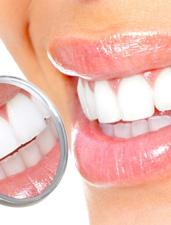 Close up of smile with pristine teeth after teeth whitening in Dallas